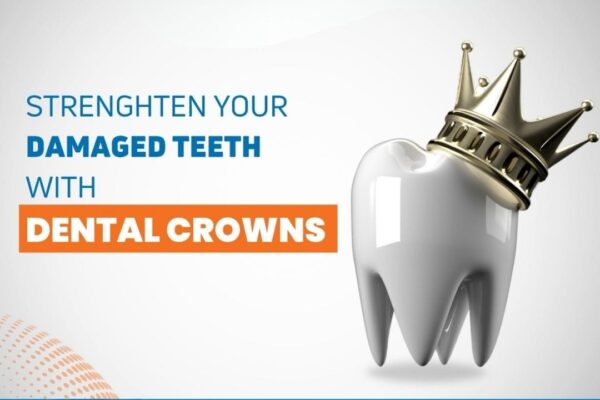 BEST DENTAL CLINIC IN NOIDA : IMPRESSIONS DENTAL CLINIC