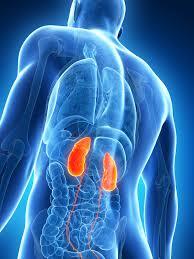 kidney disease