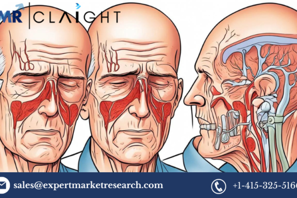 Giant Cell Arteritis Treatment Market