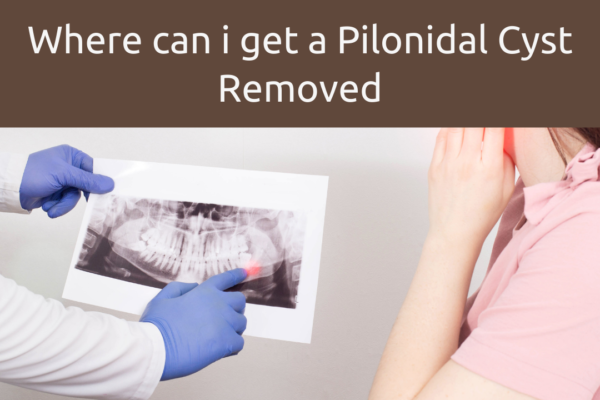 where can i get a pilonidal cyst removed