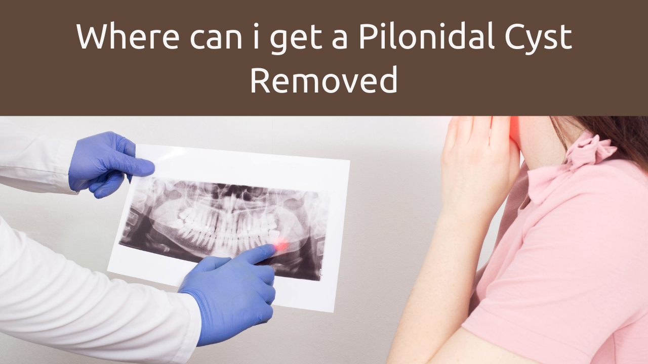 where can i get a pilonidal cyst removed