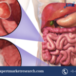 North America In-Vitro Colorectal Cancer Screening Tests Market