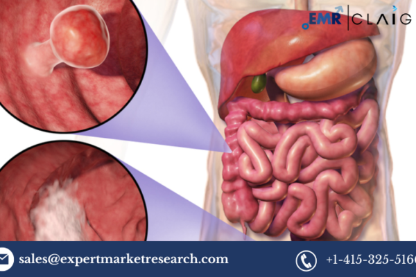 North America In-Vitro Colorectal Cancer Screening Tests Market