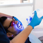 Teeth Whitening in Riyadh